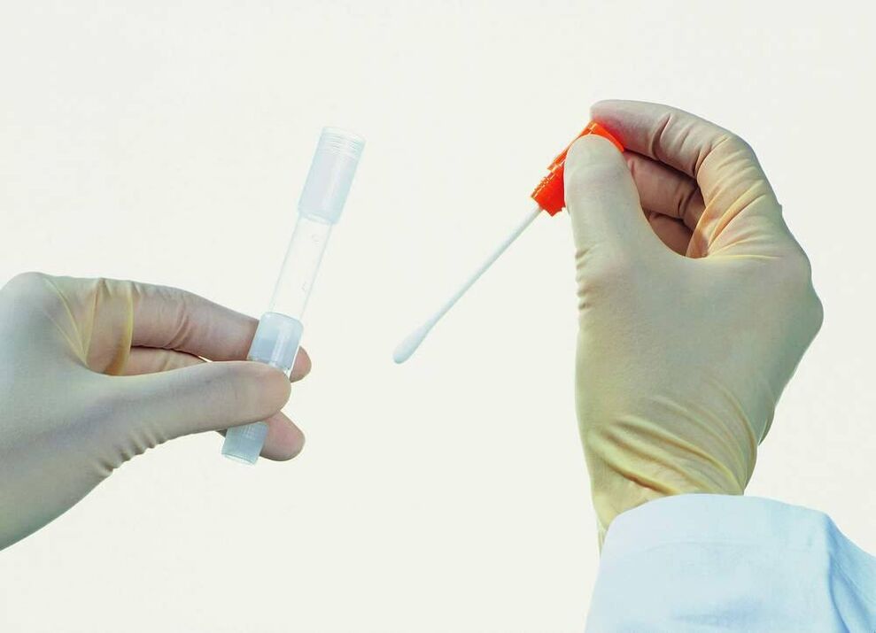 Tester sammelen fir chronesch Prostatitis z'entdecken